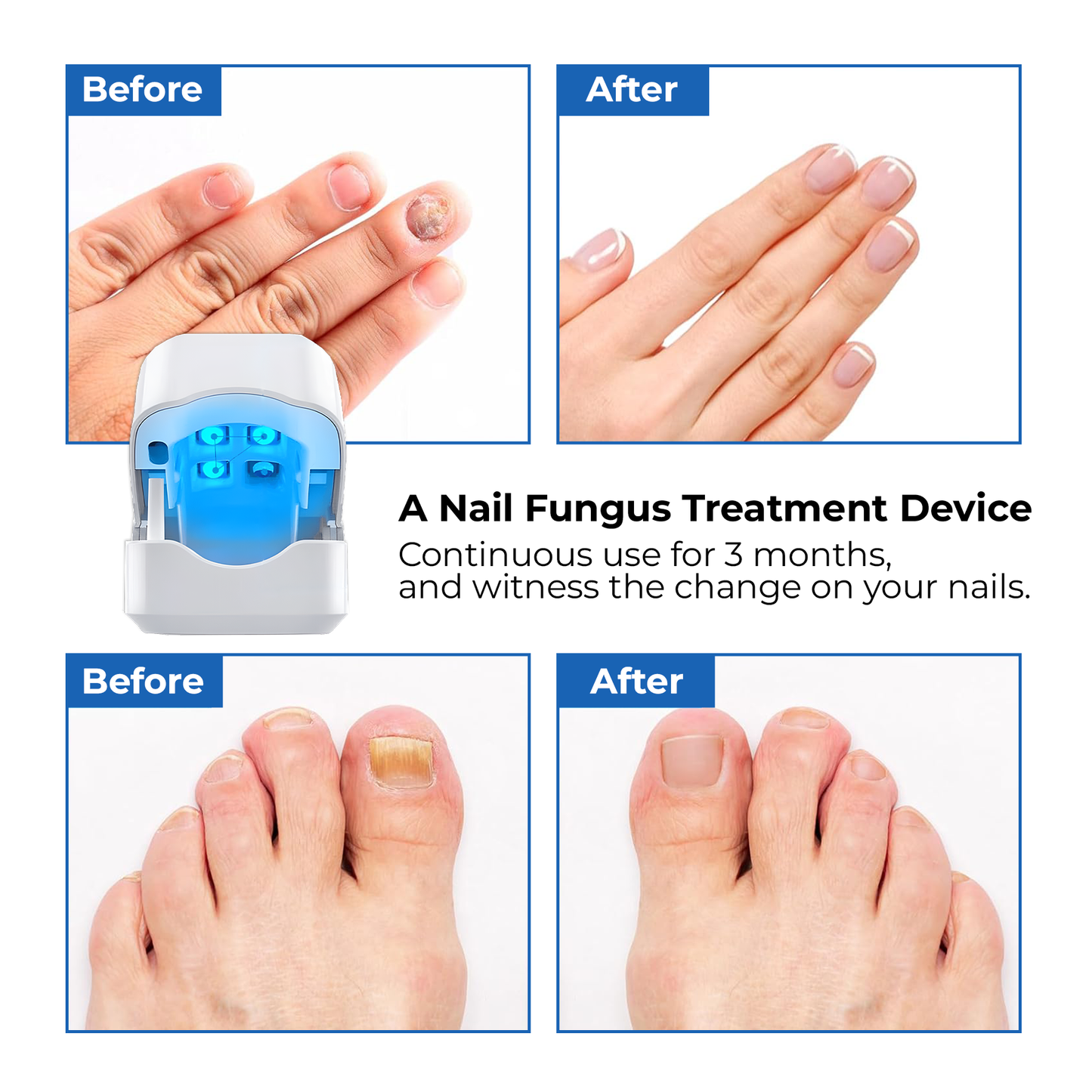 FungaLite Restore™