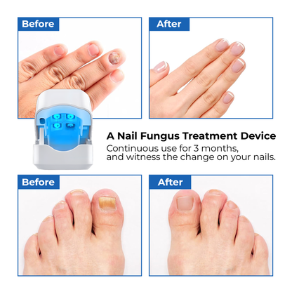 FungaLite Restore™
