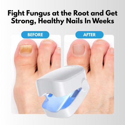 FungaLite Restore™